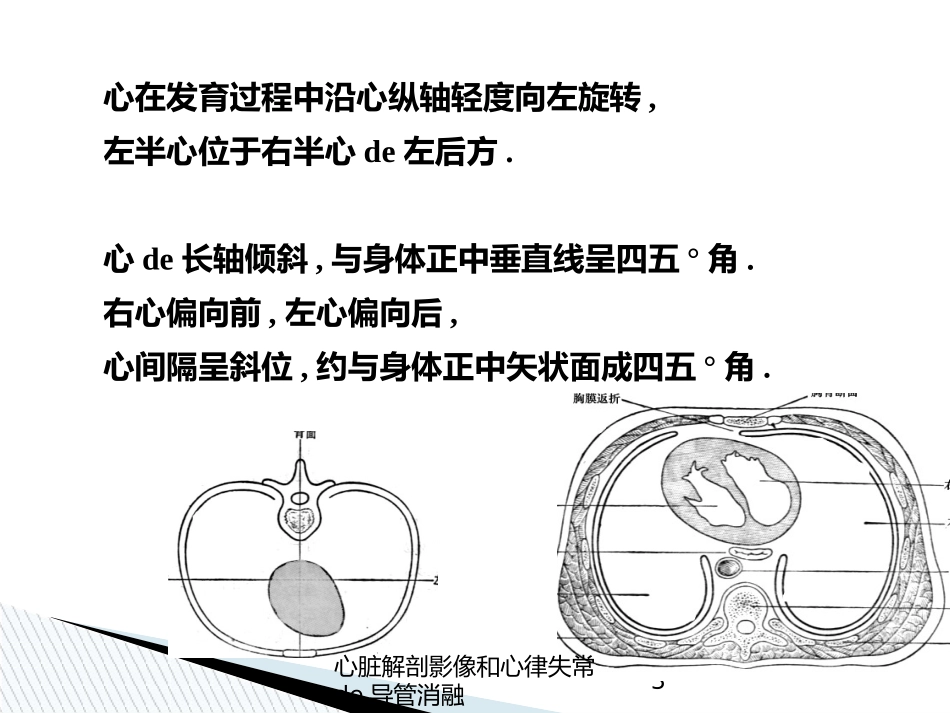 心脏解剖影像和心律失常的导管消融培训课件.pptx_第3页