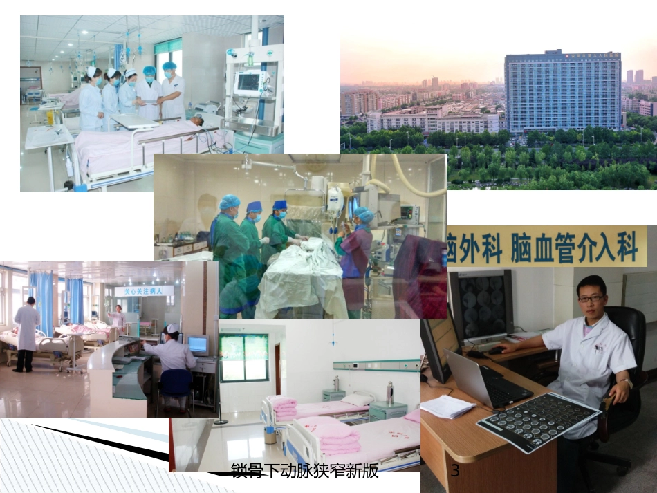 锁骨下动脉狭窄新版培训课件.pptx_第3页