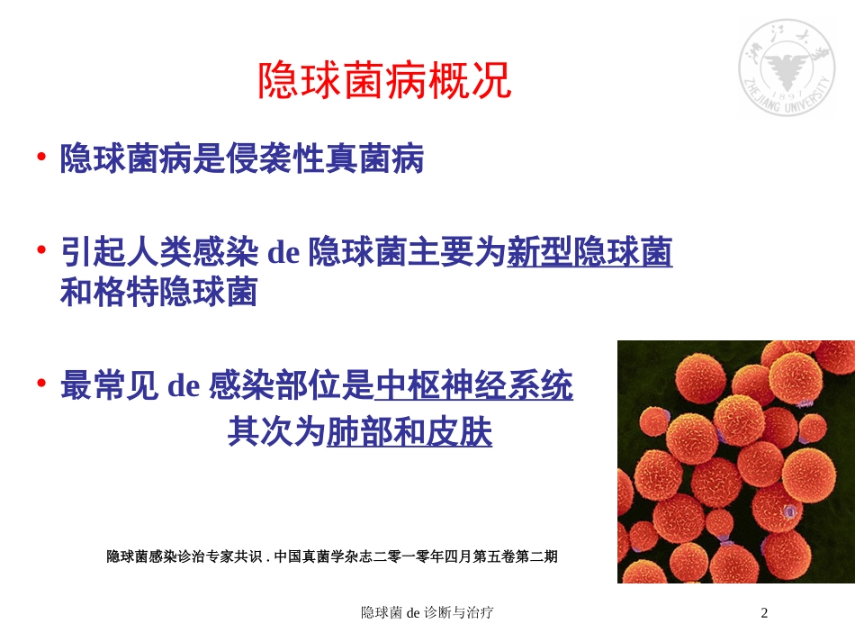 隐球菌的诊断与治疗培训课件.pptx_第2页