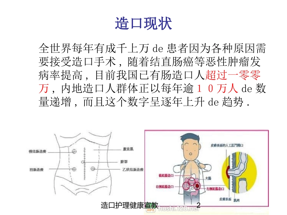 造口护理健康宣教培训课件.pptx_第2页