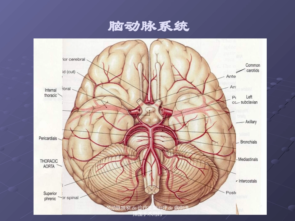 颈动脉狭窄的诊疗支架治疗的病例选择围手术用药培训课件.pptx_第2页