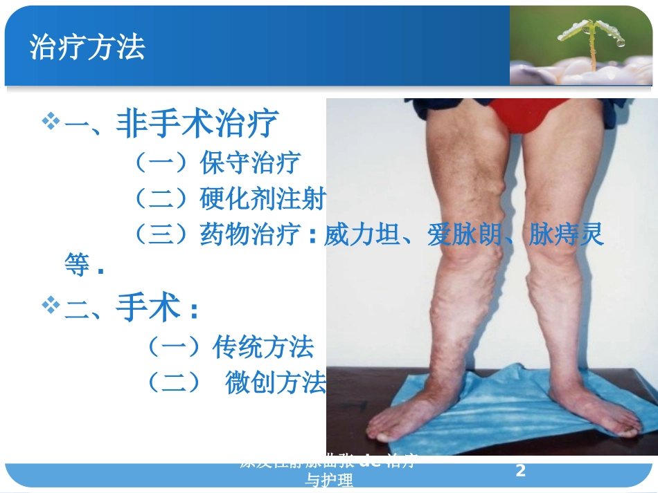 原发性静脉曲张的治疗与护理培训课件.pptx_第2页