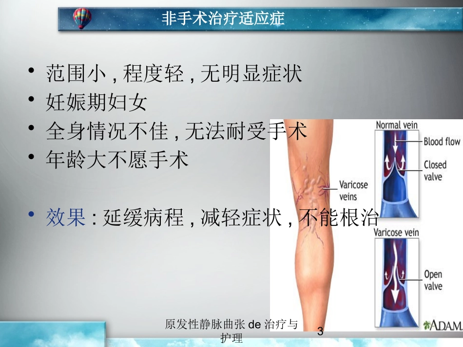 原发性静脉曲张的治疗与护理培训课件.pptx_第3页