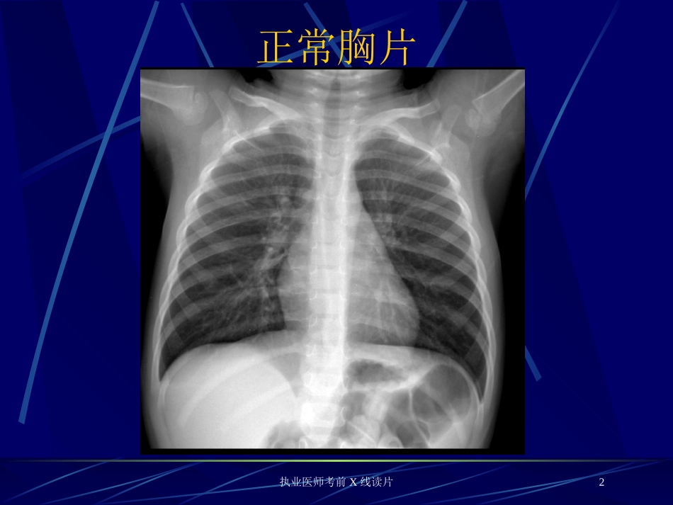 执业医师考前X线读片培训课件.pptx_第2页