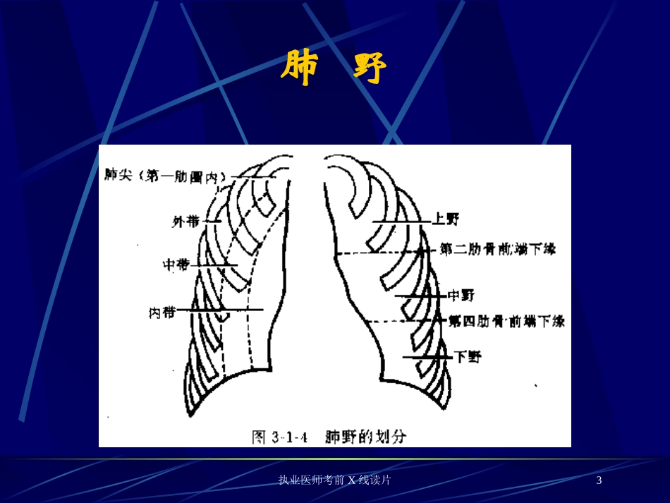 执业医师考前X线读片培训课件.pptx_第3页