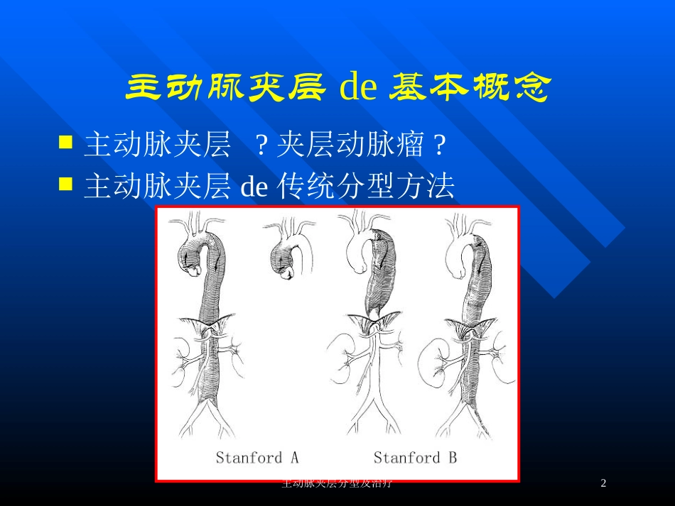 主动脉夹层分型及治疗培训课件.pptx_第2页