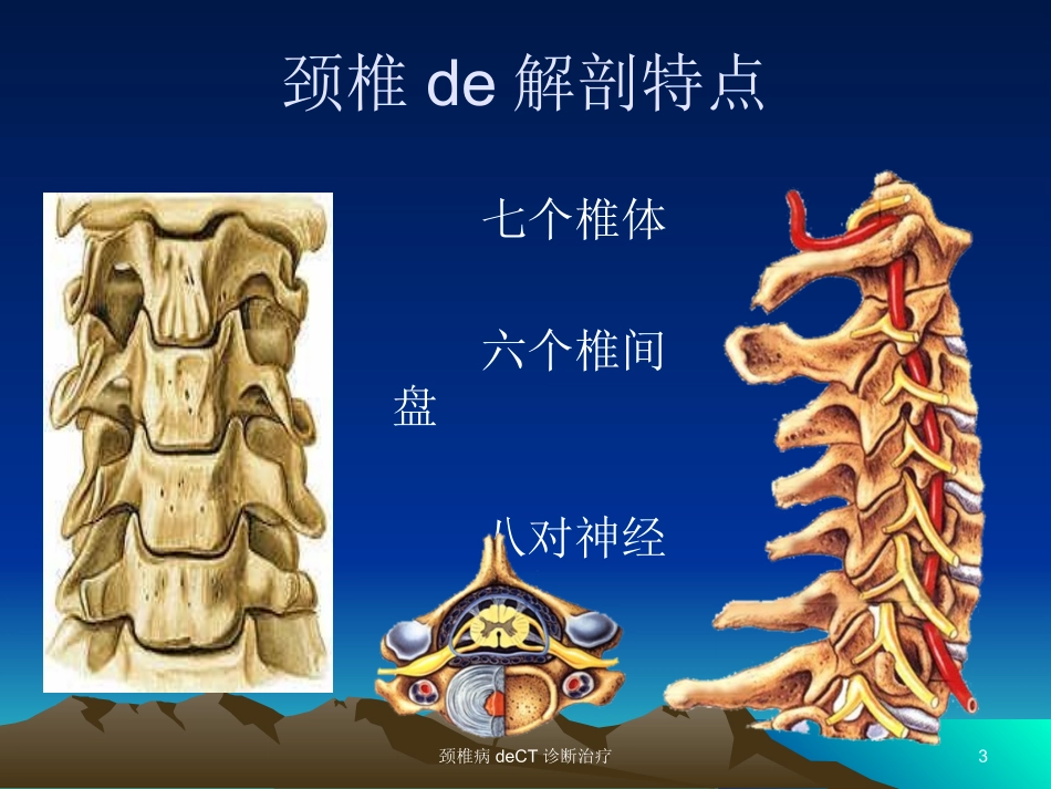 颈椎病的CT诊断治疗培训课件.pptx_第3页