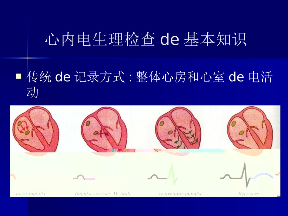 阵发性室上性心动过速宣贯培训课件.pptx_第3页