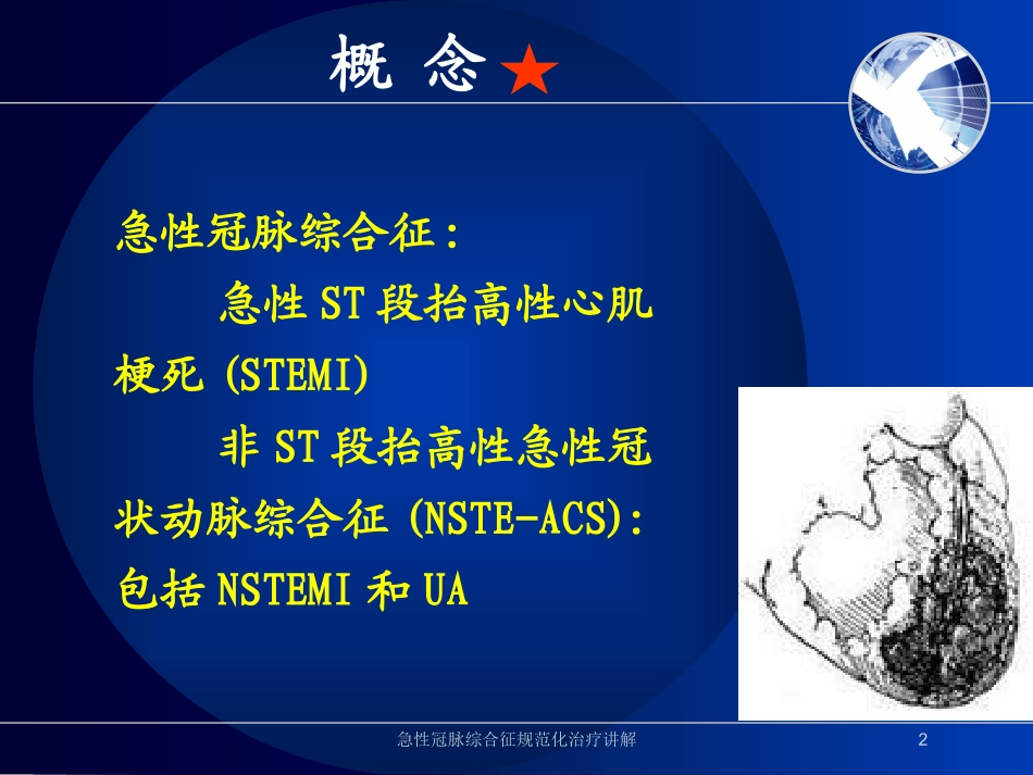急性冠脉综合征规范化治疗讲解培训课件.pptx_第2页