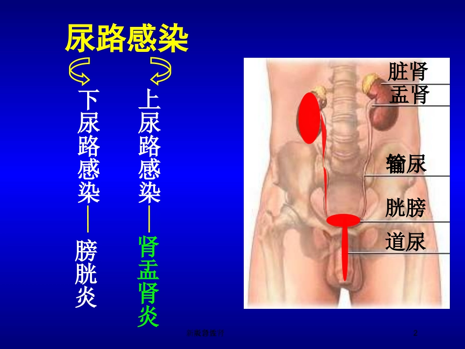 急性肾盂肾炎新版培训课件.pptx_第2页