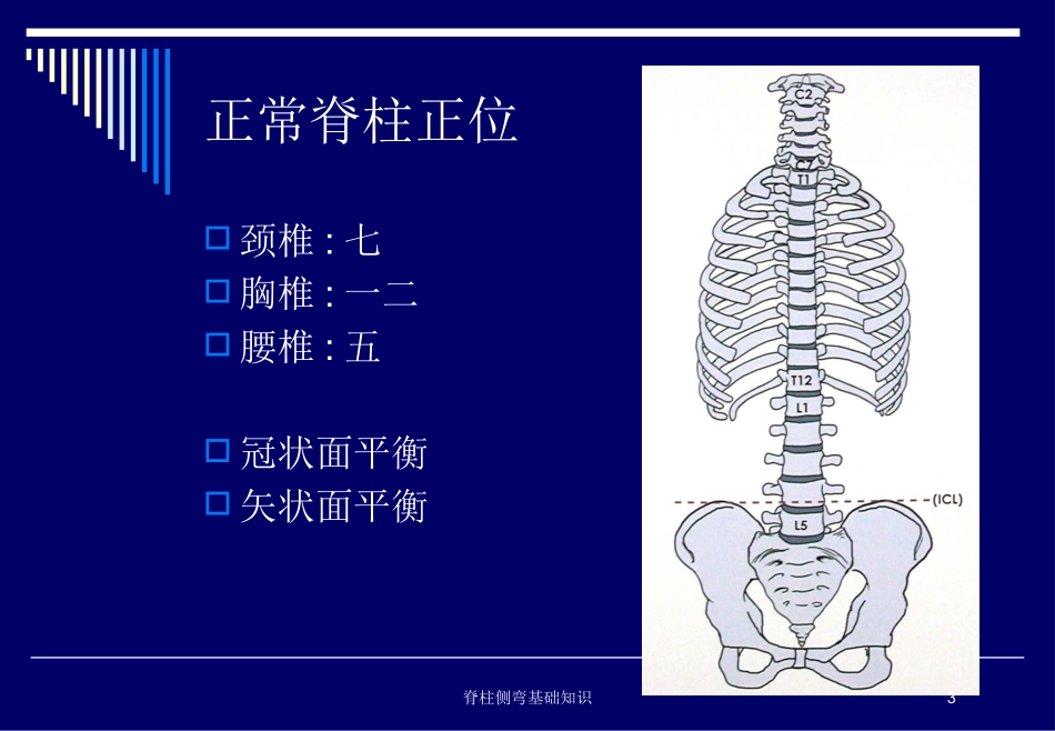 脊柱侧弯基础知识培训课件.pptx_第3页