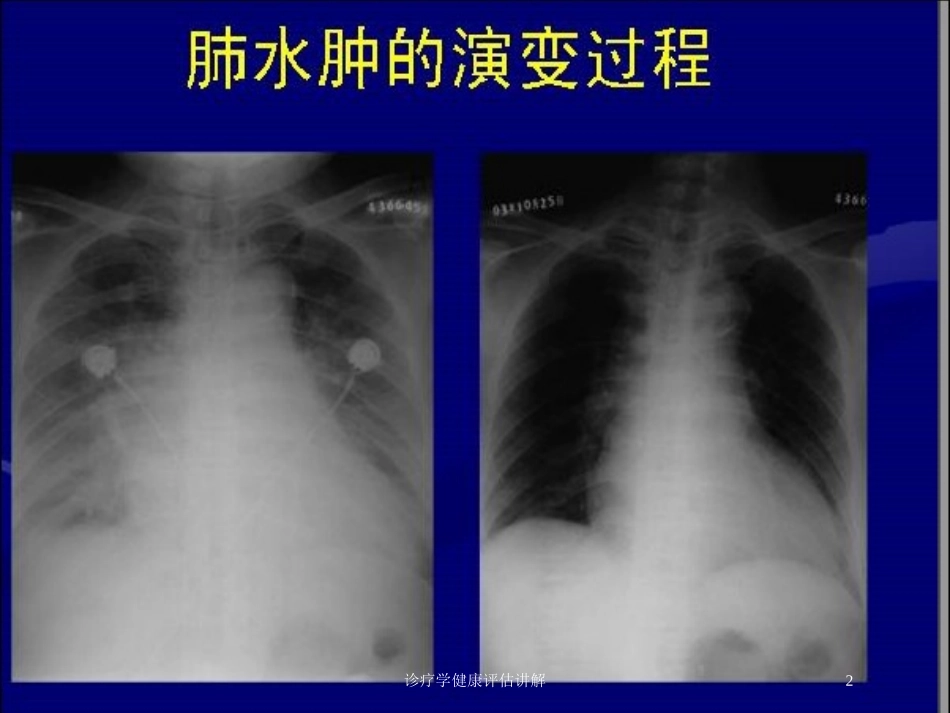 诊疗学健康评估讲解培训课件.pptx_第2页