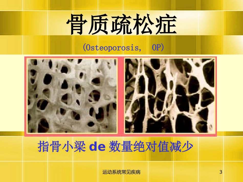 运动系统常见疾病培训课件.pptx_第3页