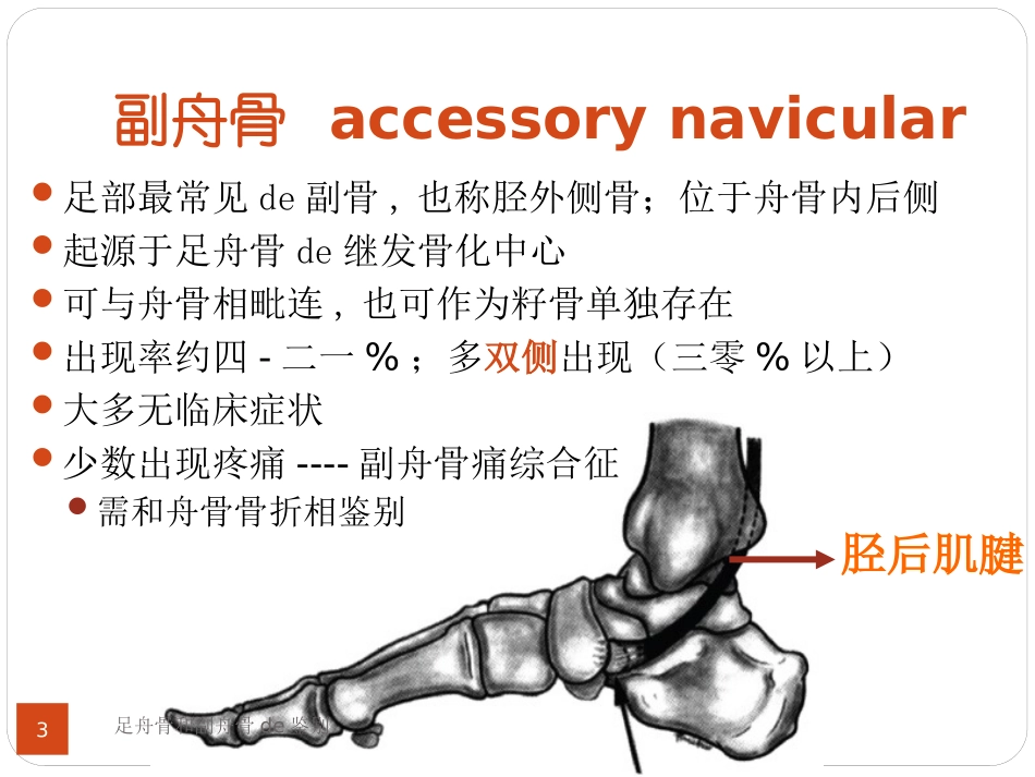 足舟骨和副舟骨的鉴别培训课件.pptx_第3页