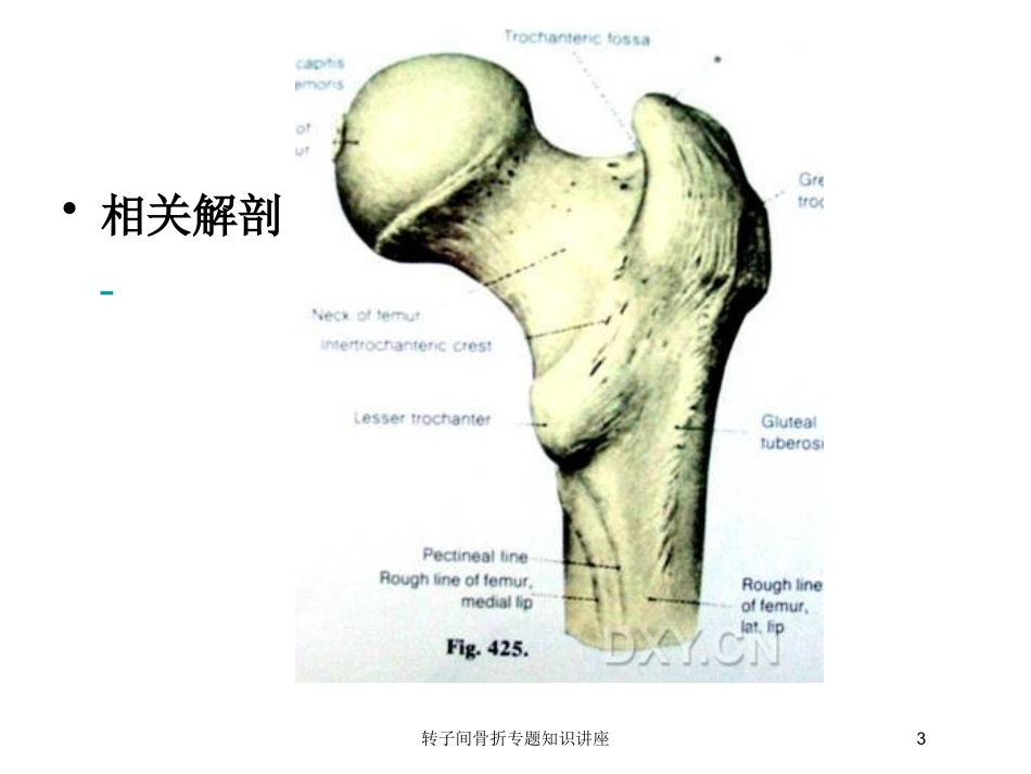 转子间骨折专题知识讲座培训课件.pptx_第3页
