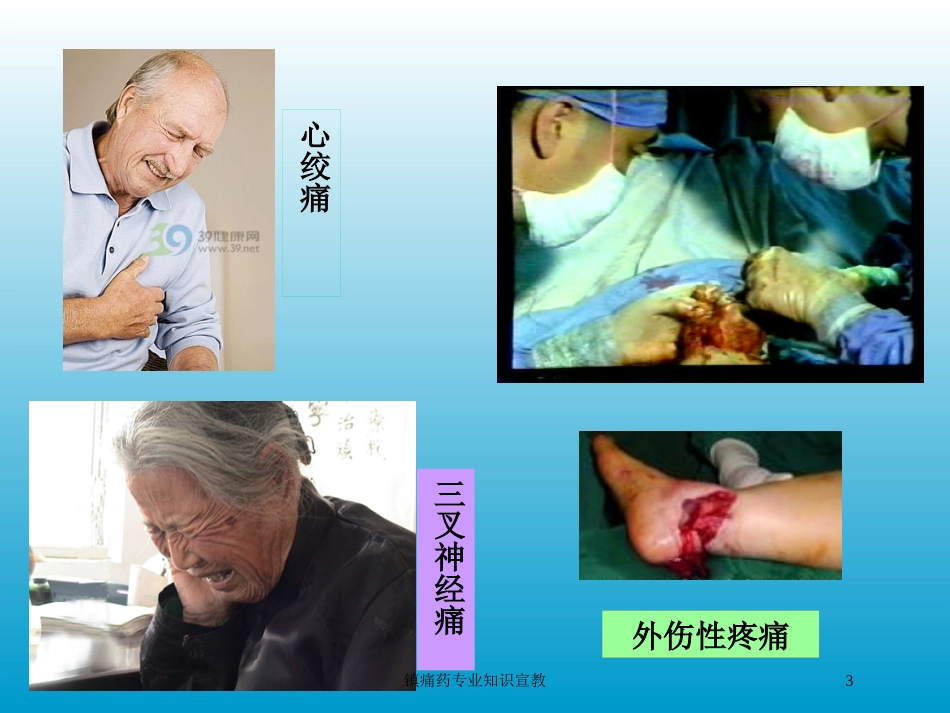 镇痛药专业知识宣教培训课件.pptx_第3页