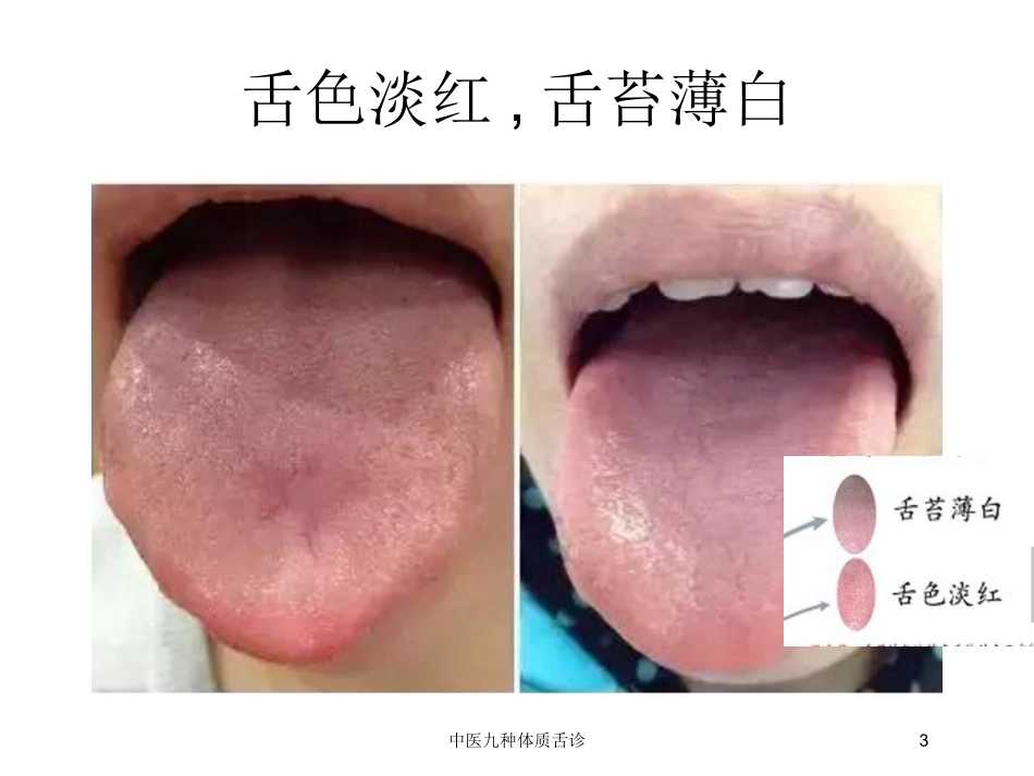 中医九种体质舌诊培训课件.pptx_第3页