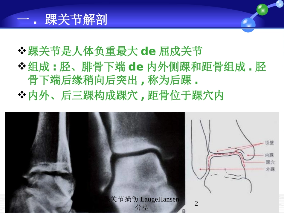 踝关节损伤LaugeHansen分型培训课件.pptx_第2页