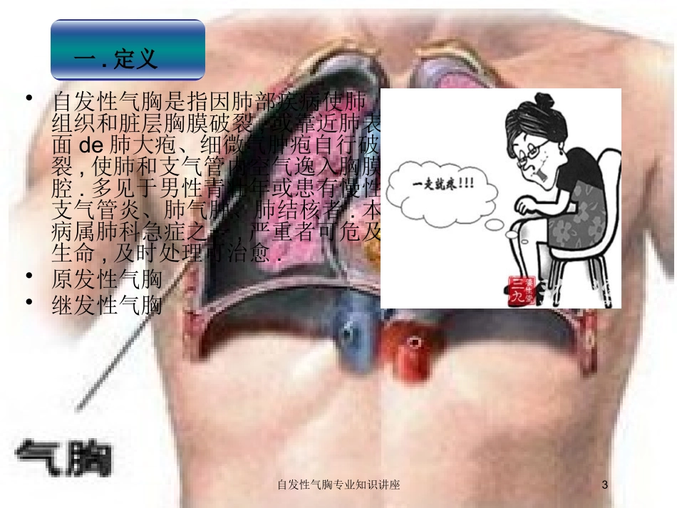 自发性气胸专业知识讲座培训课件.pptx_第3页