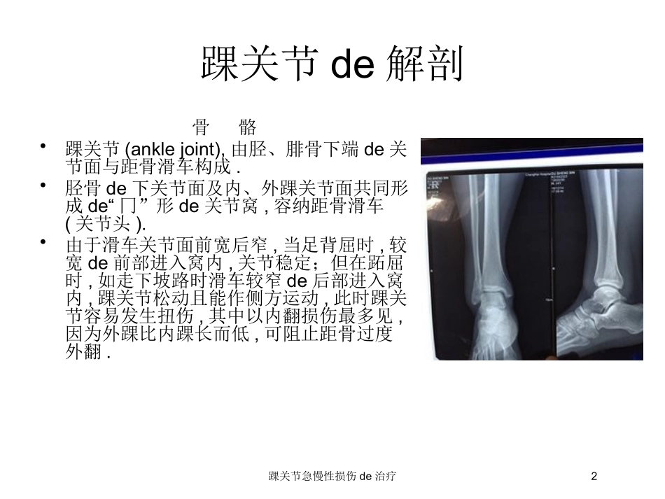 踝关节急慢性损伤的治疗培训课件.pptx_第2页