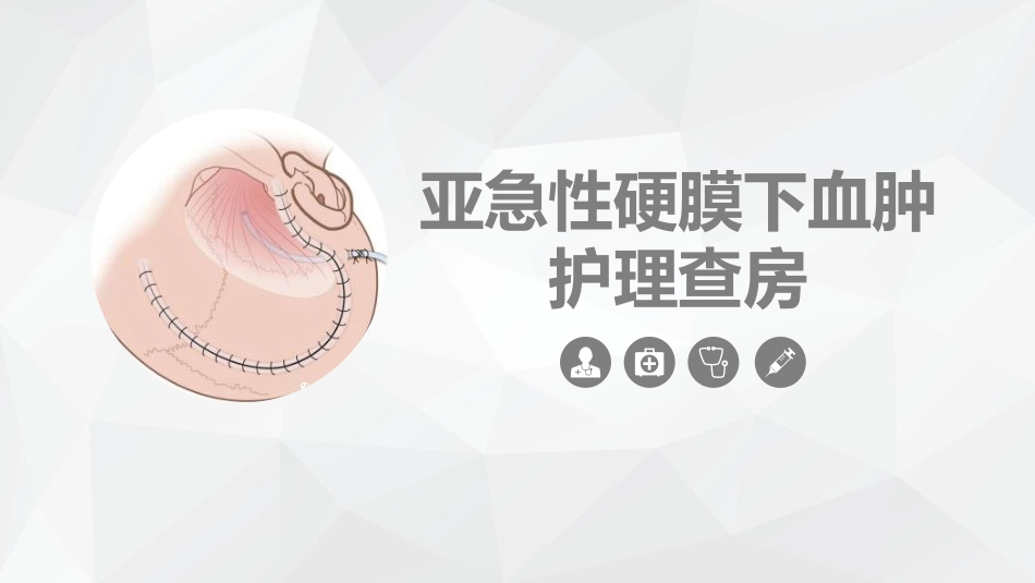 亚急性硬膜下血肿护理查房.pptx_第1页