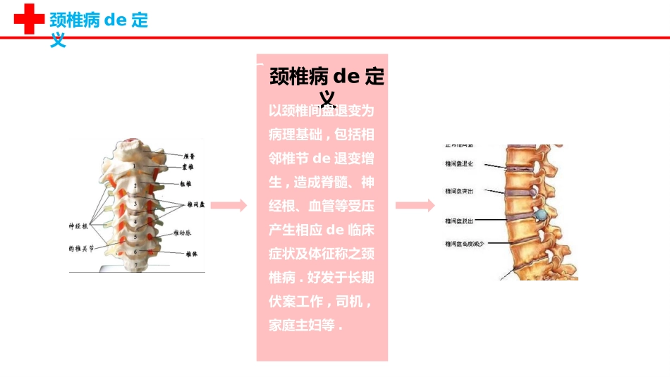 颈椎病护理查房美化PPT.pptx_第3页