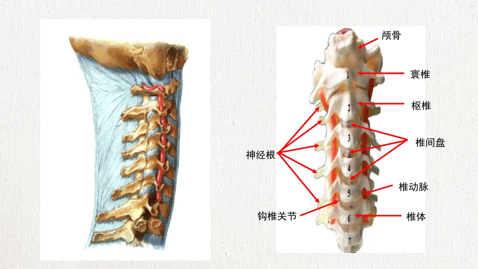 颈椎病护理查房-8 (2).pptx_第2页