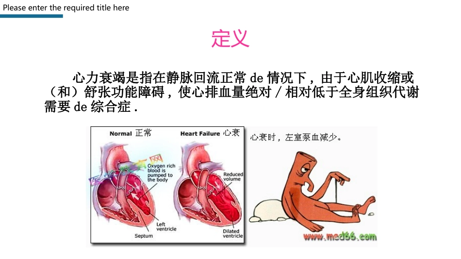 心力衰竭护理查房PPT模板 (2).pptx_第3页
