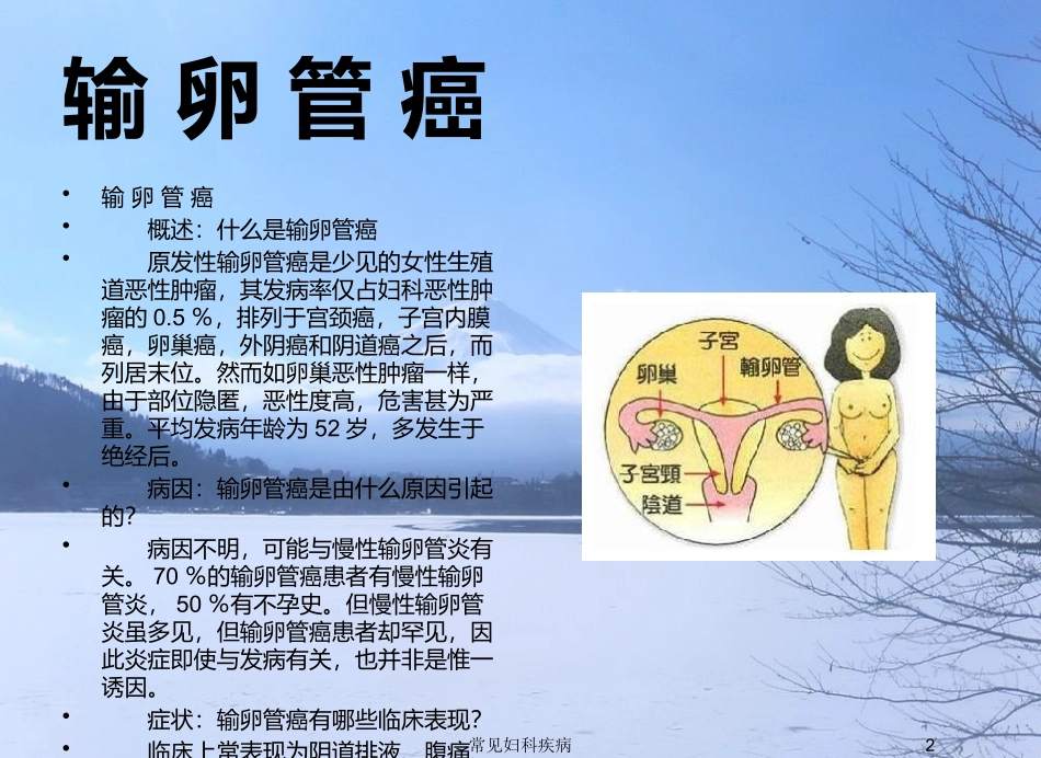 常见妇科疾病培训课件.pptx_第2页