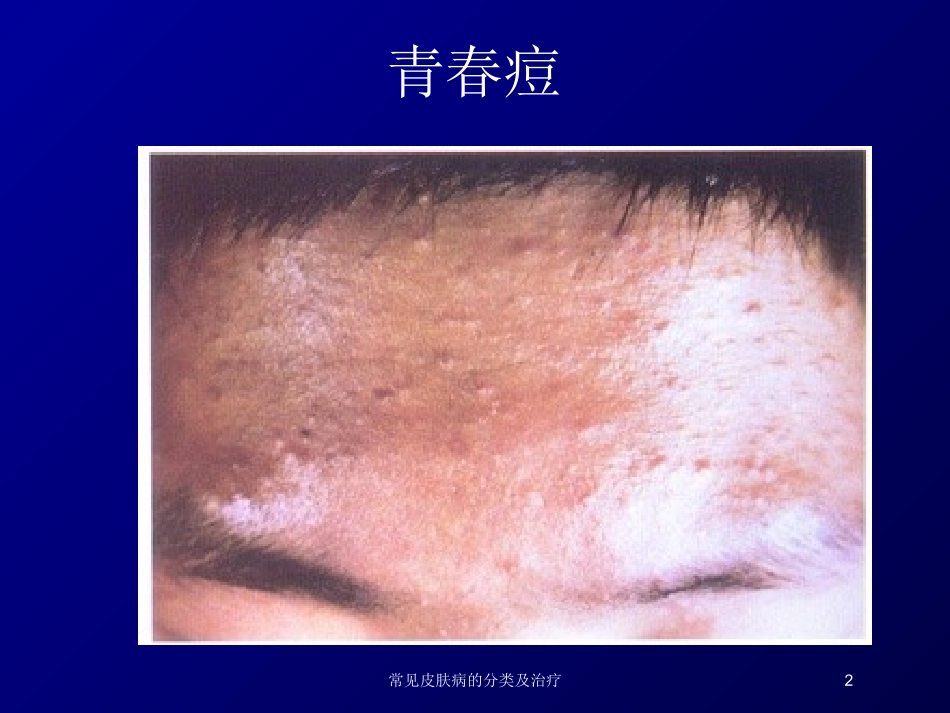 常见皮肤病的分类及治疗培训课件.pptx_第2页