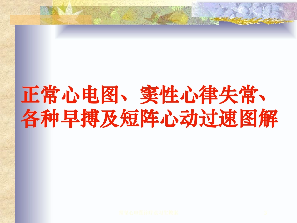 常见心电图诊疗实习生教案培训课件.pptx_第3页