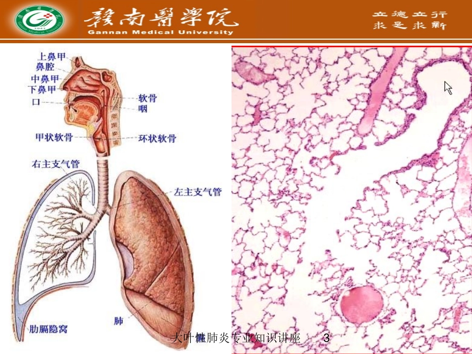 大叶性肺炎专业知识讲座培训课件.pptx_第3页