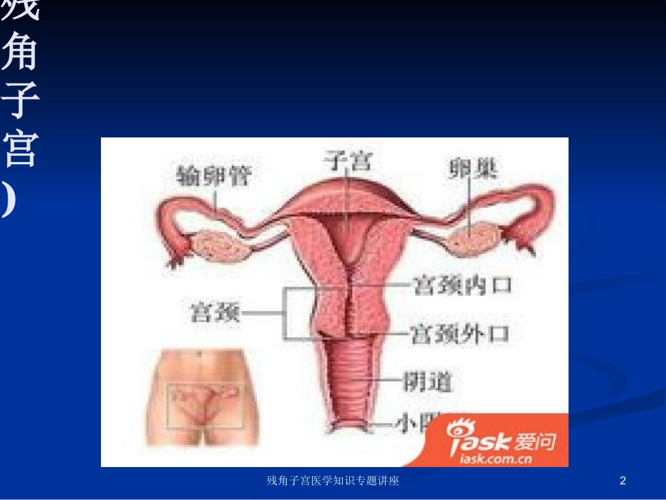 残角子宫医学知识专题讲座培训课件.pptx_第2页