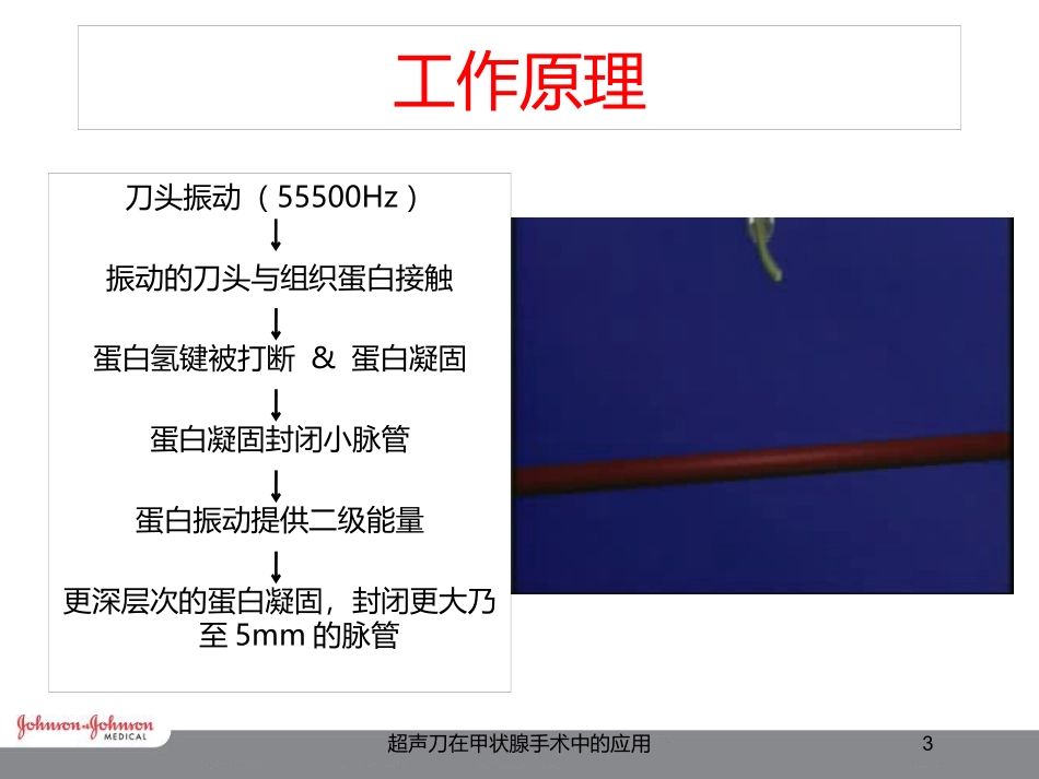 超声刀在甲状腺手术中的应用培训课件.pptx_第3页