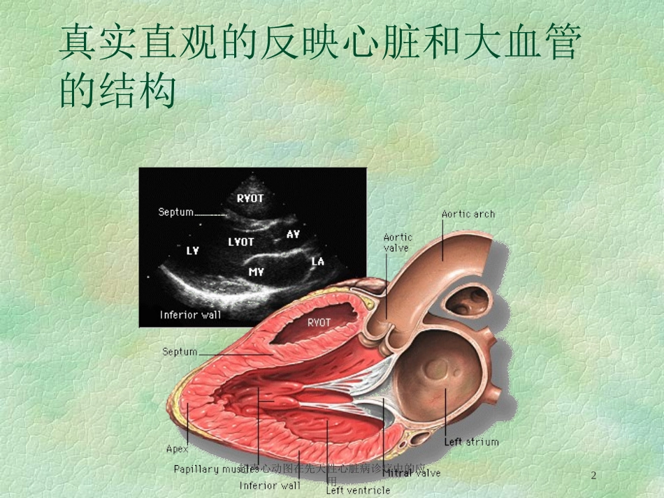 超声心动图在先天性心脏病诊疗中的应用培训课件.pptx_第2页