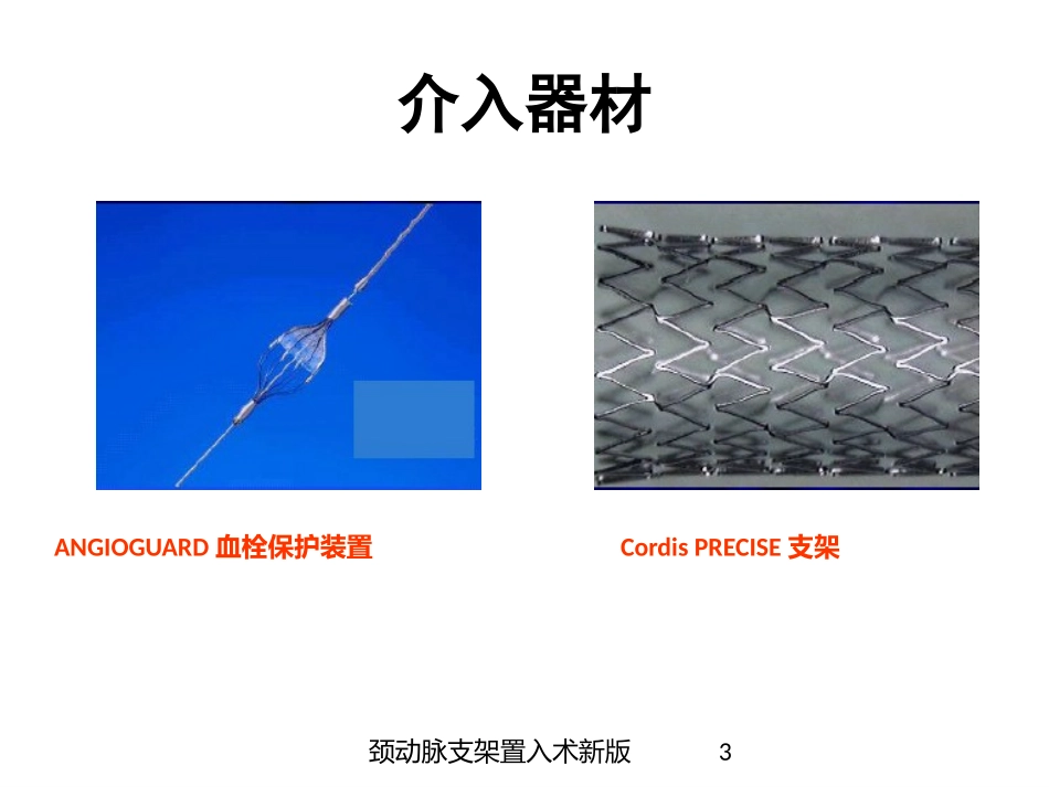 颈动脉支架置入术新版培训课件.pptx_第3页