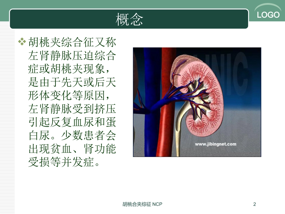胡桃合夹综征NCP培训课件.pptx_第2页