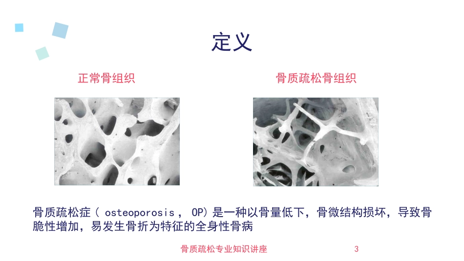 骨质疏松专业知识讲座培训课件.pptx_第3页