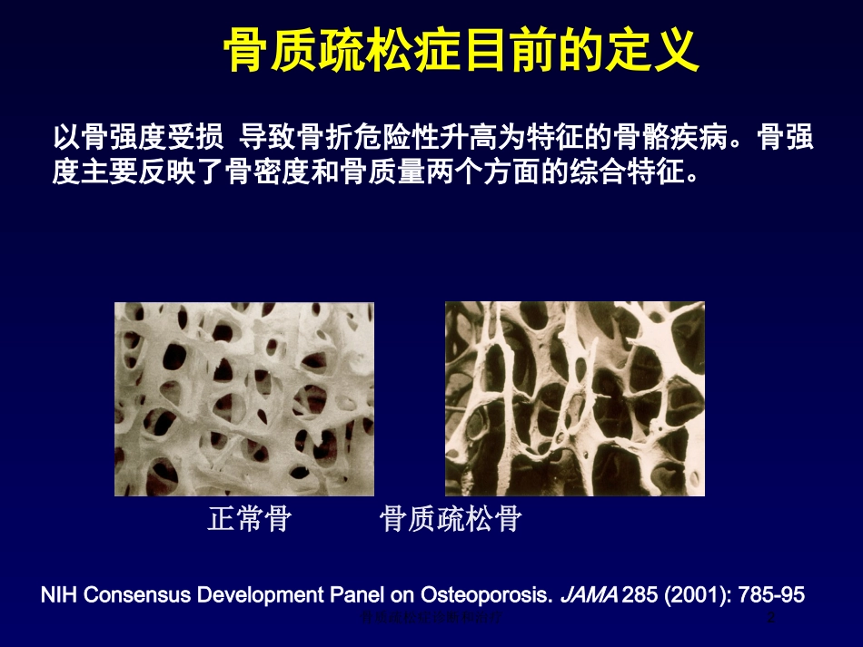 骨质疏松症诊断和治疗培训课件.pptx_第2页