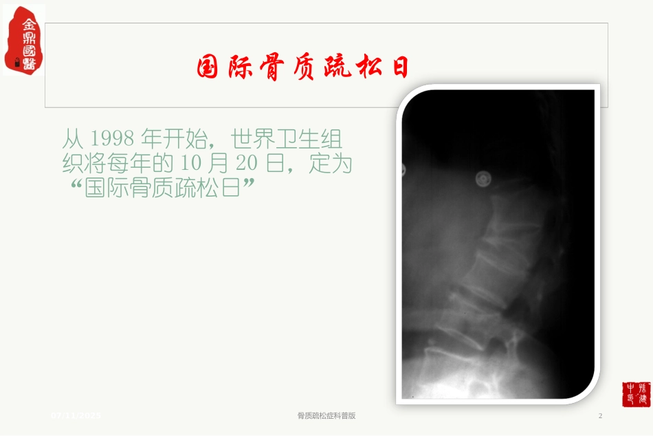 骨质疏松症科普版培训课件.pptx_第2页