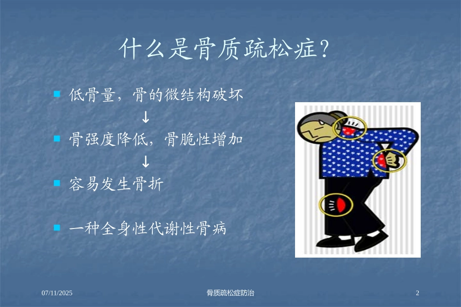 骨质疏松症防治培训课件.pptx_第2页