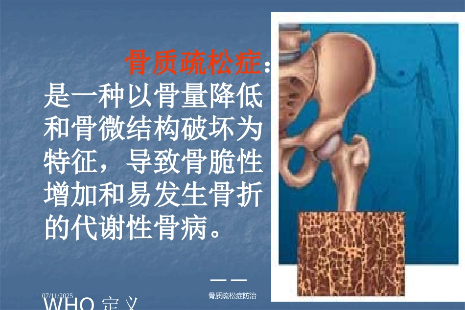 骨质疏松症防治培训课件.pptx_第3页