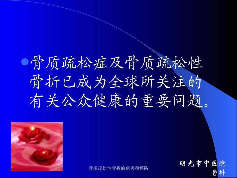 骨质疏松性骨折的危害和预防培训课件.pptx_第2页