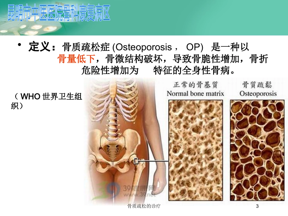 骨质疏松的诊疗培训课件.pptx_第3页