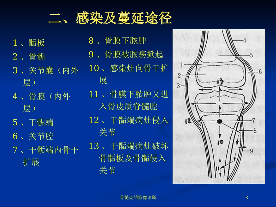 骨髓炎的影像诊断培训课件.pptx_第3页