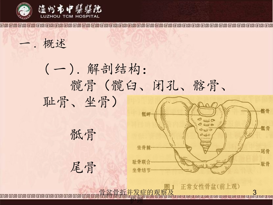骨盆骨折并发症的观察及护理培训课件.pptx_第3页
