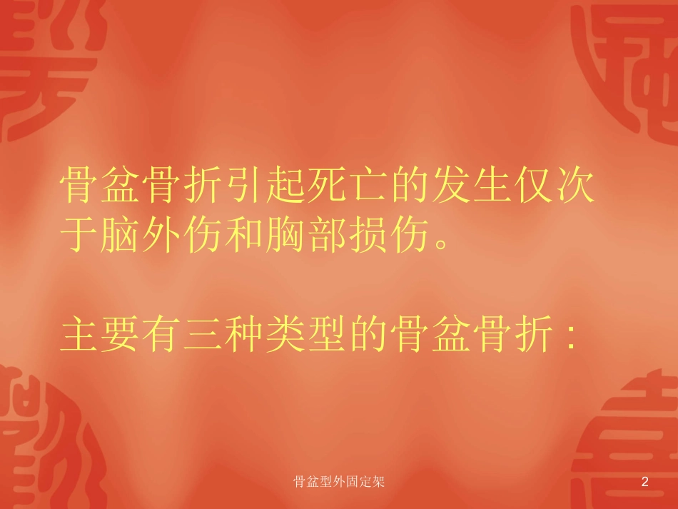 骨盆型外固定架培训课件.pptx_第2页