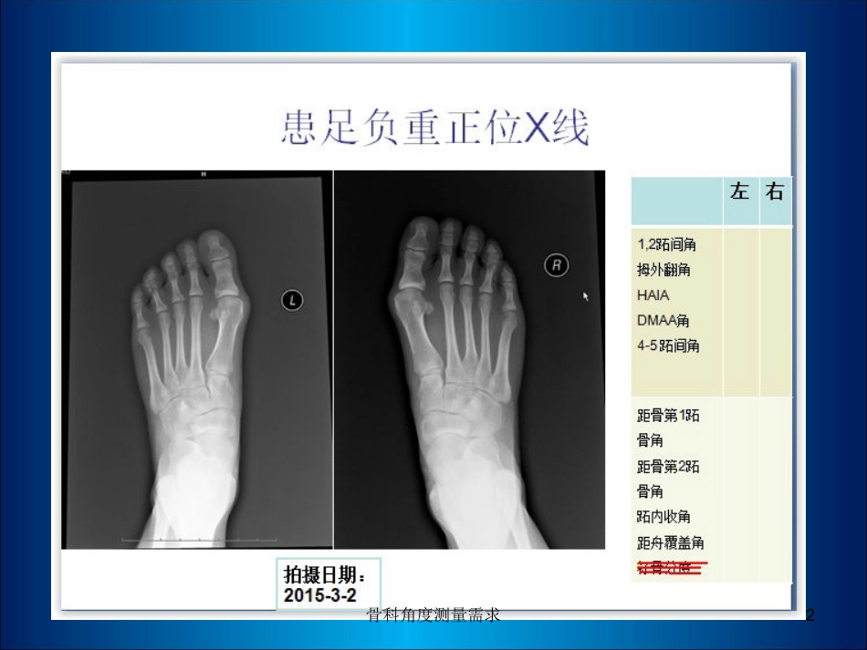 骨科角度测量需求培训课件.pptx_第2页