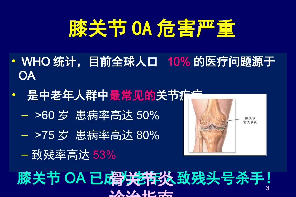 骨关节炎诊治指南培训课件.pptx_第3页