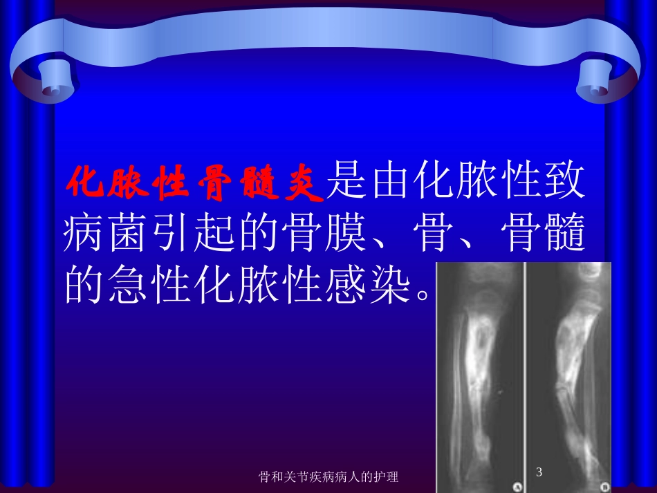 骨和关节疾病病人的护理培训课件.pptx_第3页